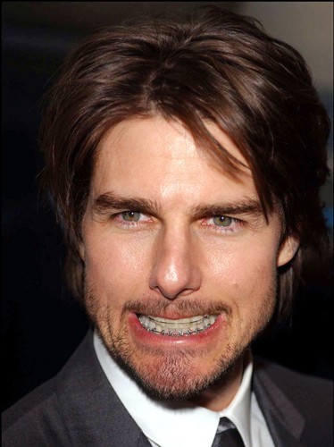 Tom Cruise dentier